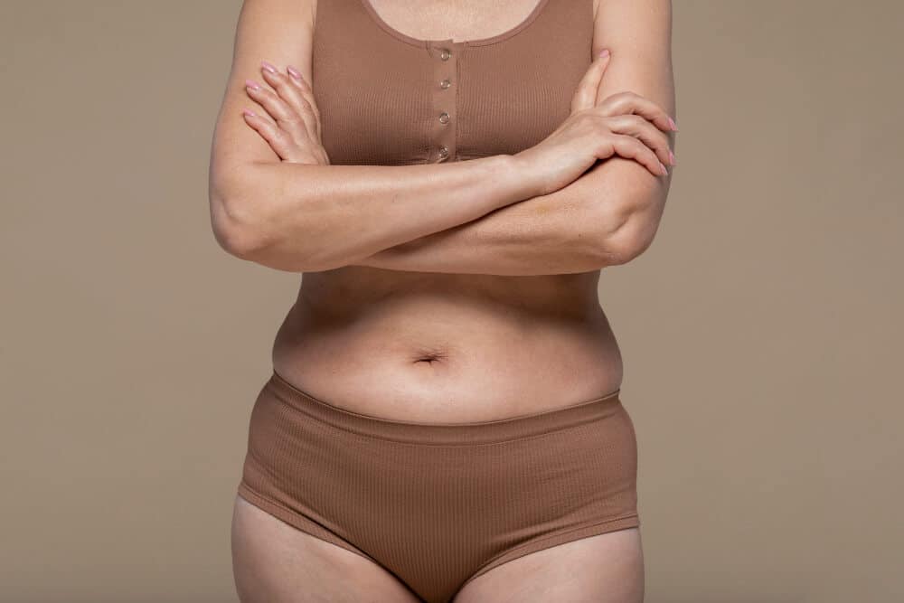 cicatrice après abdominoplastie